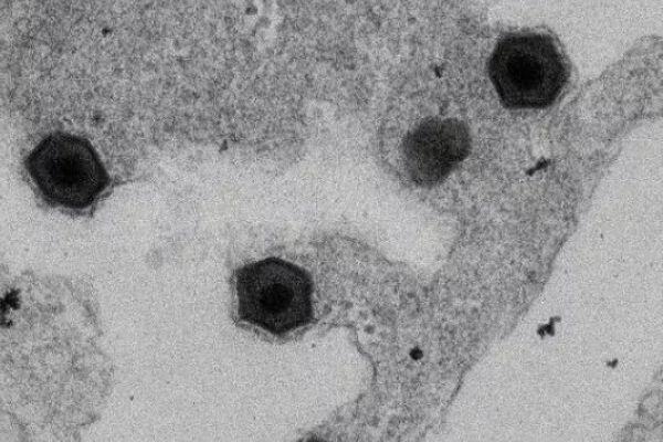 非洲猪瘟知识介绍（1）