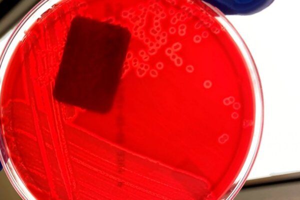 实验室诊断：水肿病