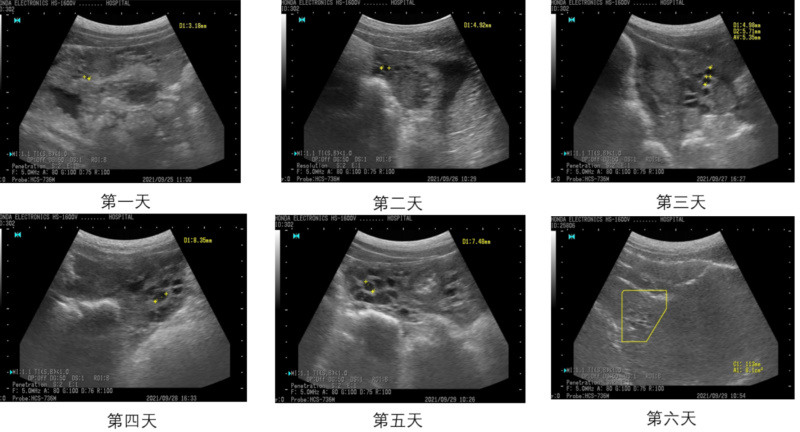 伟杰信猪批次化生产方案发布，配种率和妊娠率可提高15-20%